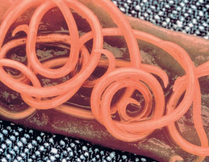 Tapeworm from human body