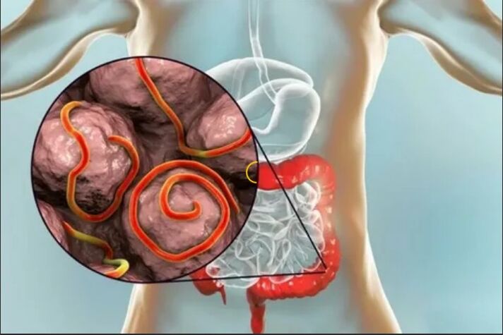 Parasites in human organisms