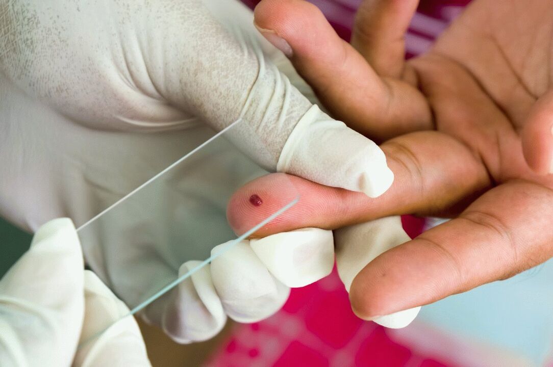 Blood test of fingers