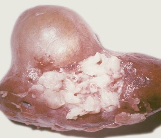 What is a parasite
