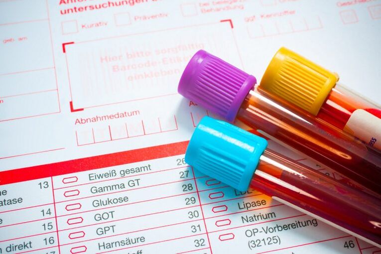 Blood from parasite research